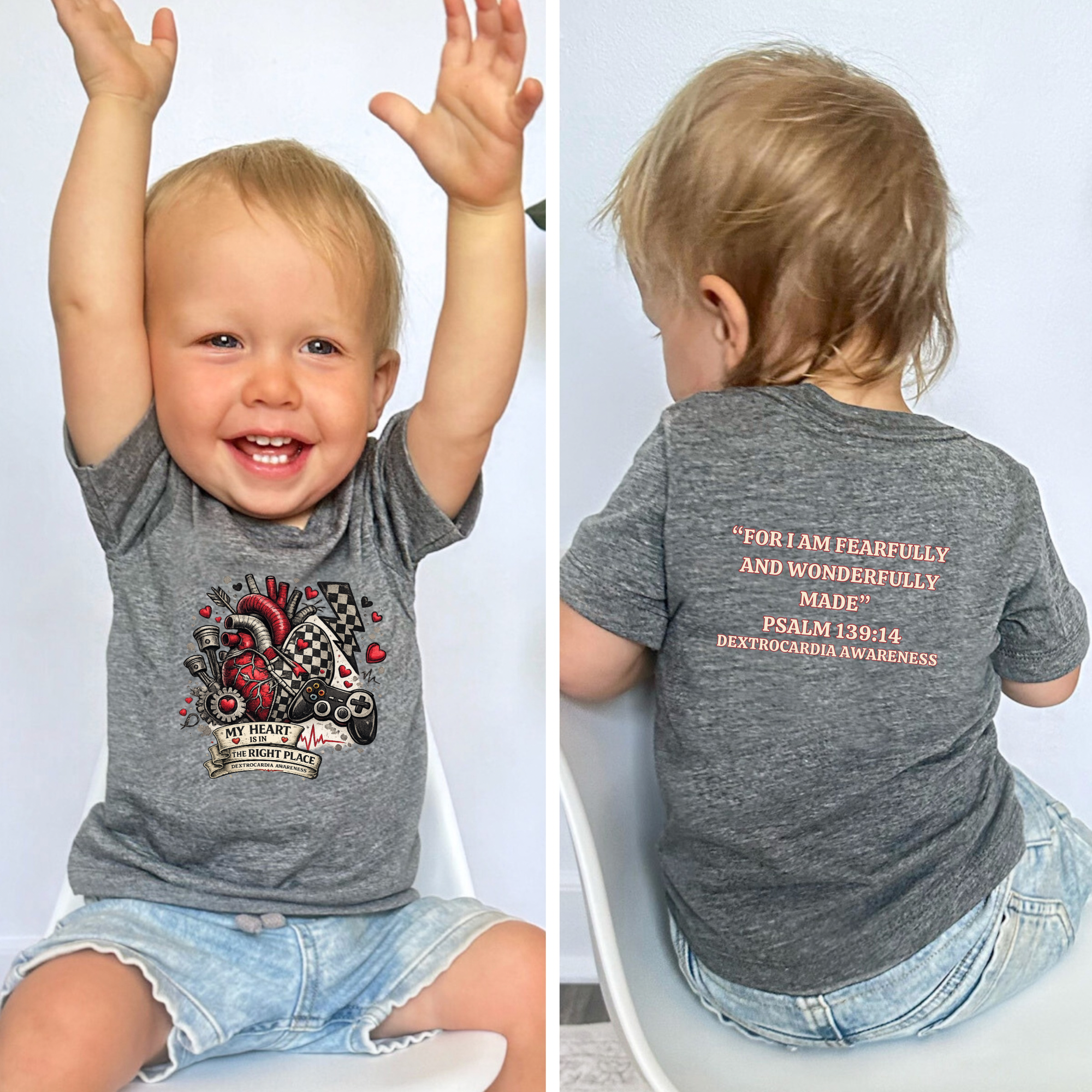 Dextrocardia Baby Short Sleeve T-Shirt — “Heart is in the Right Place”